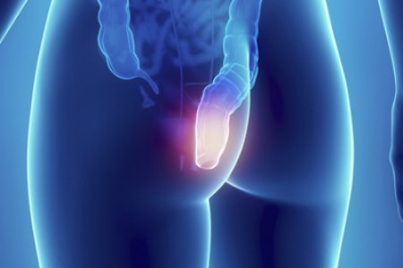 TRAS CIRUGIA DEL COLON Y EL RECTO
