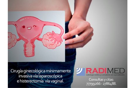 CIRUGIA GINECOLOGICA MINIMAMENTE INVASIVA