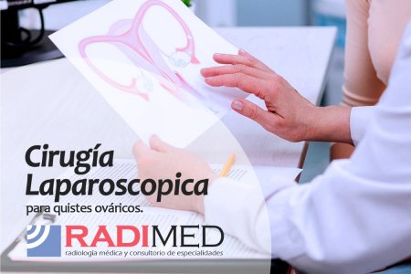 CIRUGIA LAPAROSCOPICA  PARA QUISTES DE OVARIO