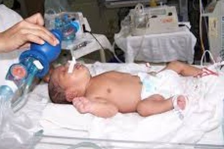 QUE CUIDADOS DEBEN DARSE AL NEONATO