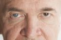 QUE ES UNA MACULA EN EL  OJO