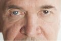 QUE ES UNA MACULA EN EL  OJO