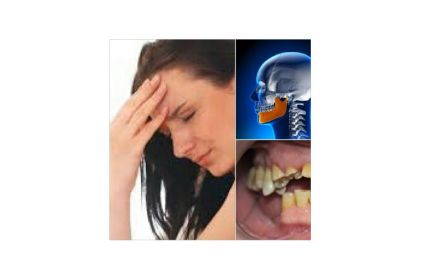 ASISTENCIA DENTAL ARTICULAR E INTEGRAL Dra. Aguirre