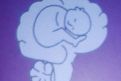 NEUROLOGO INFANTIL Dr. Escobar