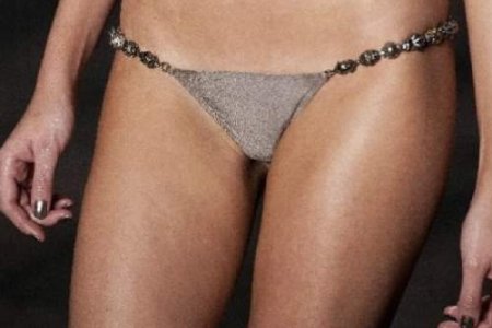 CIRUGÍA VAGINAL