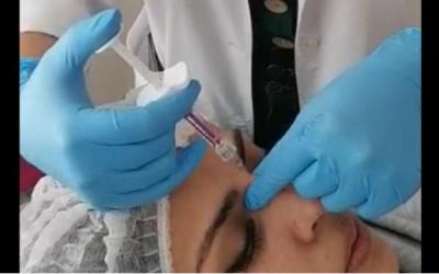 ARMONIZACION FACIAL