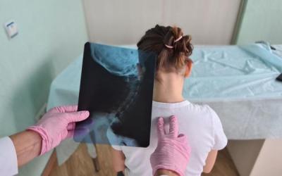 ESCOLIOSIS